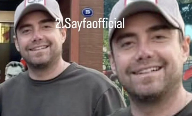 Müğənnini buna görə Maykl Ceksona bənzətdilər  - FOTO